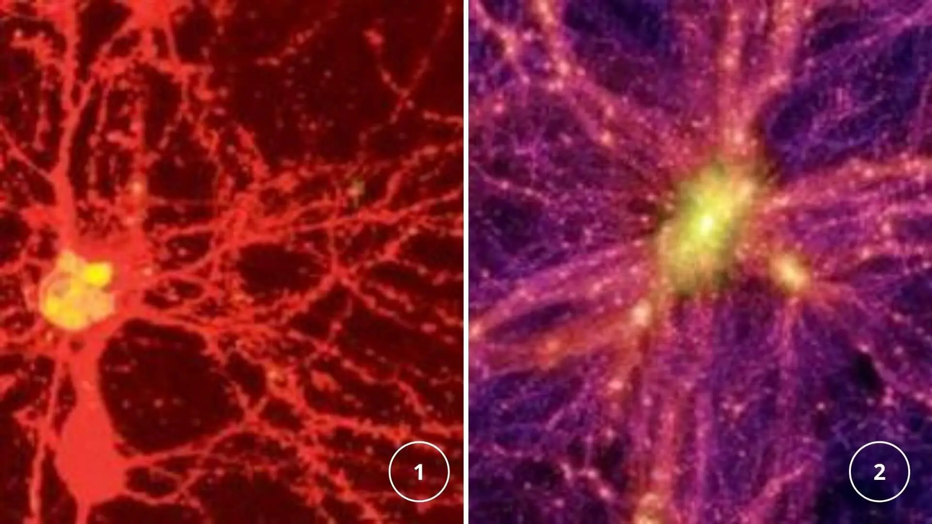 celula cerebral universo - Es el cerebro humano más complejo que el universo